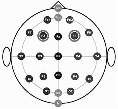 intertemporal choice